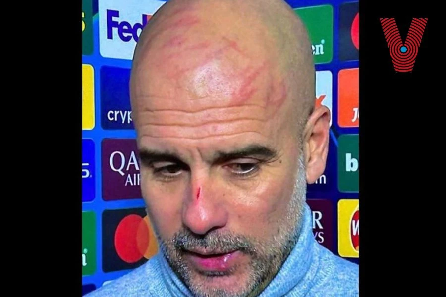 Guardiola se lesionó el rostro como frustración.